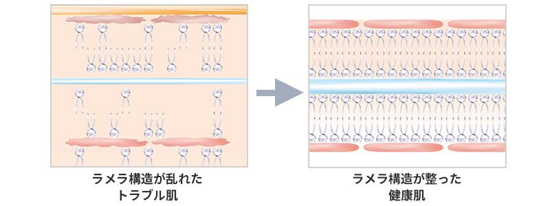 ラメラ美容法とは？